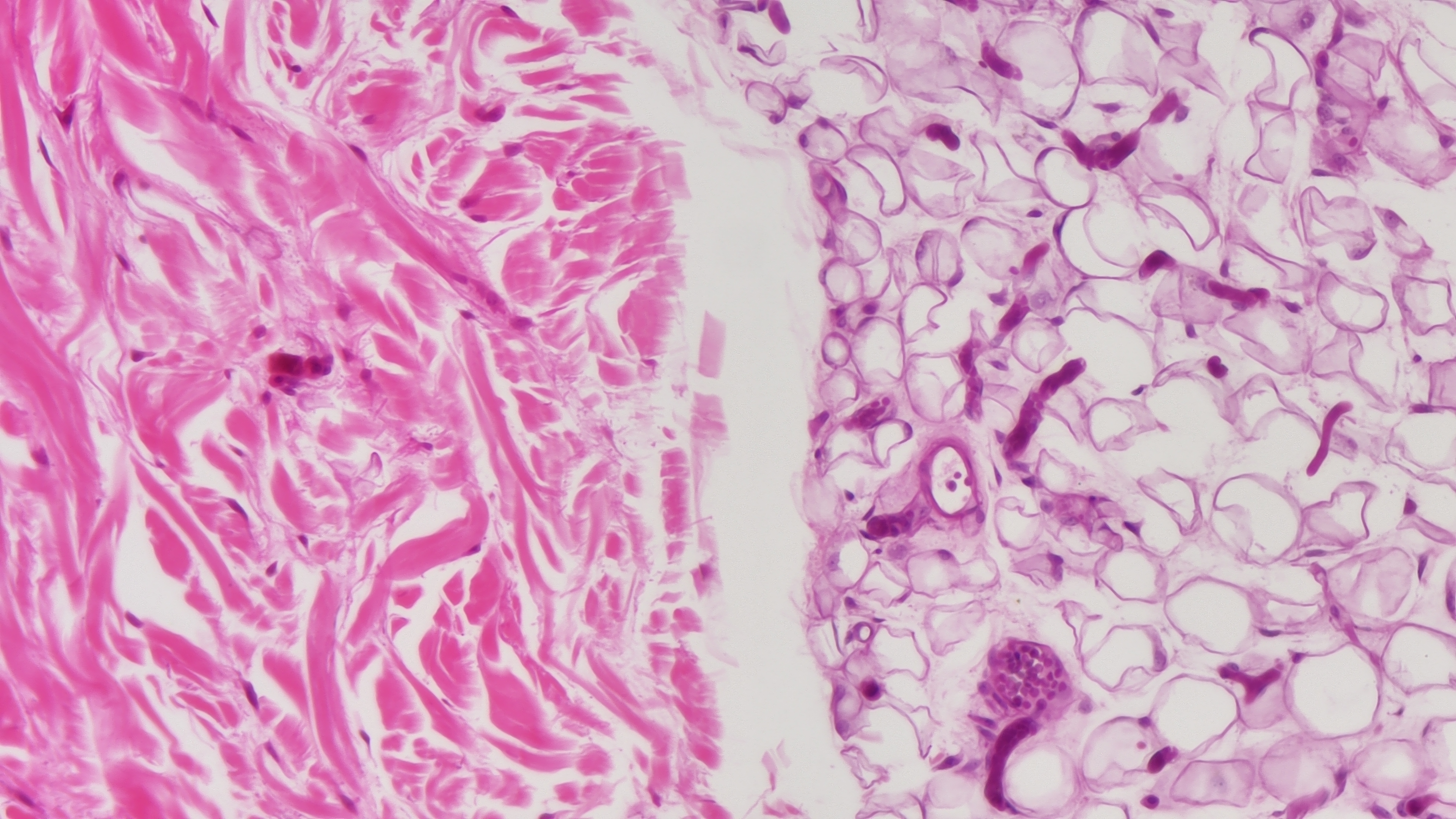 Medizinische Pathologie-Beobachtung Medizinische Pathologie-Beobachtung