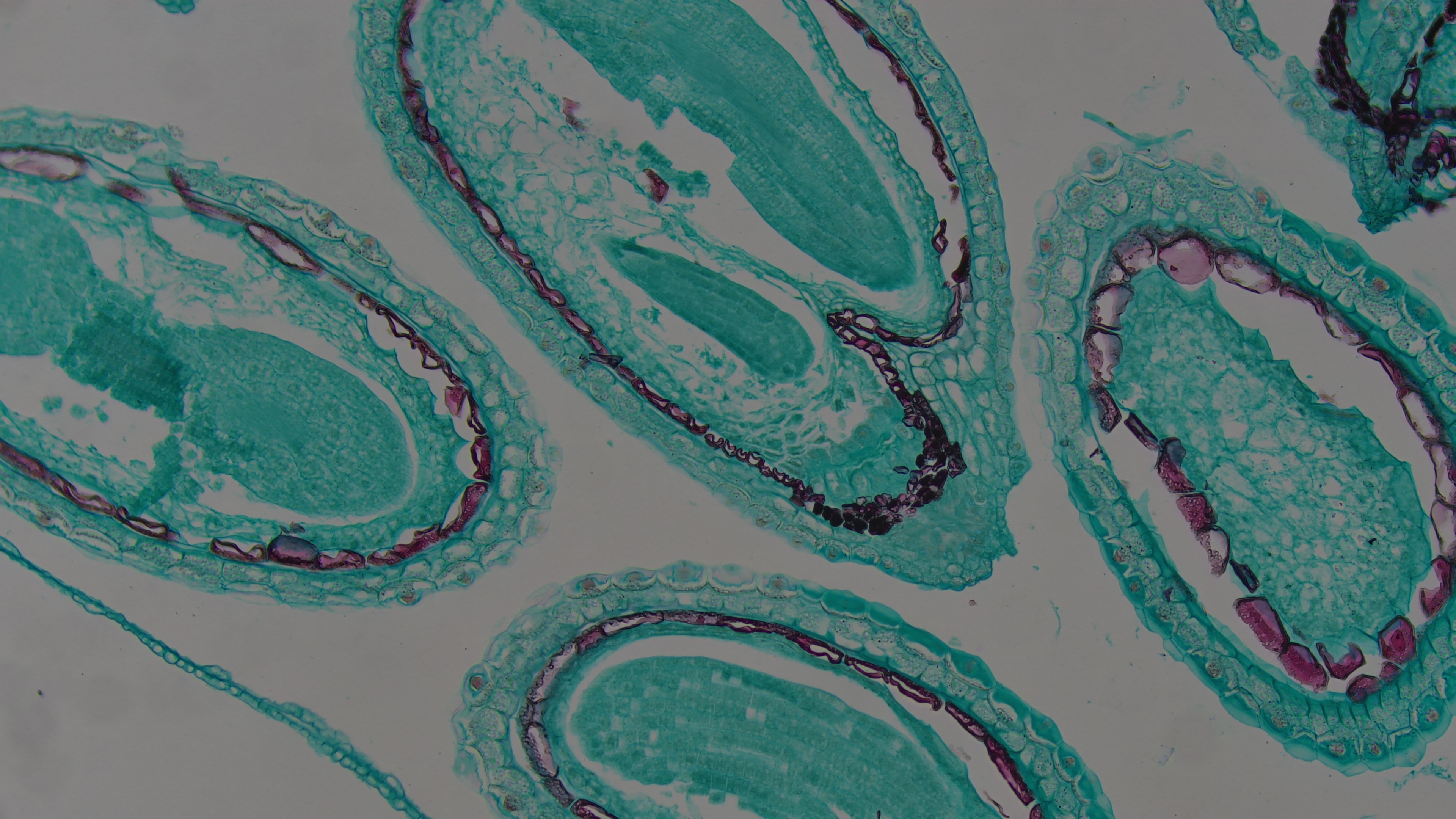 Älterer Embryo-Querschnitt von Capsella Älterer Embryo-Querschnitt von Capsella